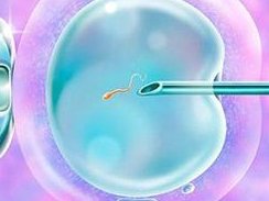 朝阳医院试管婴儿花费明细表，北京朝阳医院