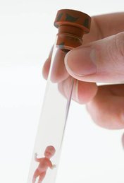 浙江大学第一医院试管婴儿医疗保险报销条件预览